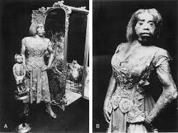 The Heartbreaking Story Of Juliana Pastrana, The Woman Buried 150 Years After Her Death