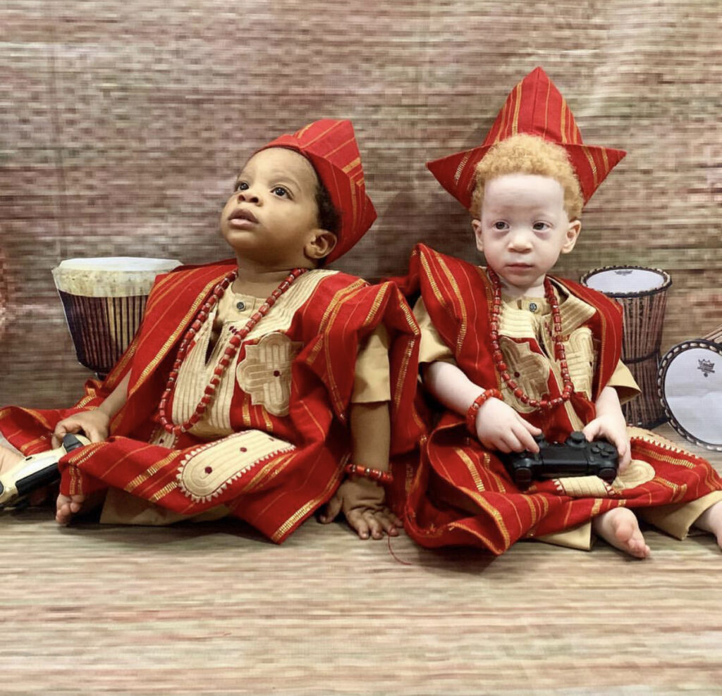 Nigerian Mum Sets The Record Straight, Her Rare “Black And White” Twin Sons Are Identical