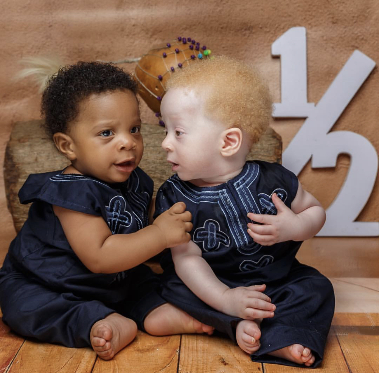 Nigerian Mum Sets The Record Straight, Her Rare "Black And White” Twin Sons Are Identical