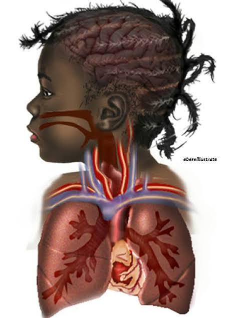 After his illustrations went viral, Nigerian medical student, Chidiebere Ibe, to have his medical illustrations of black people published