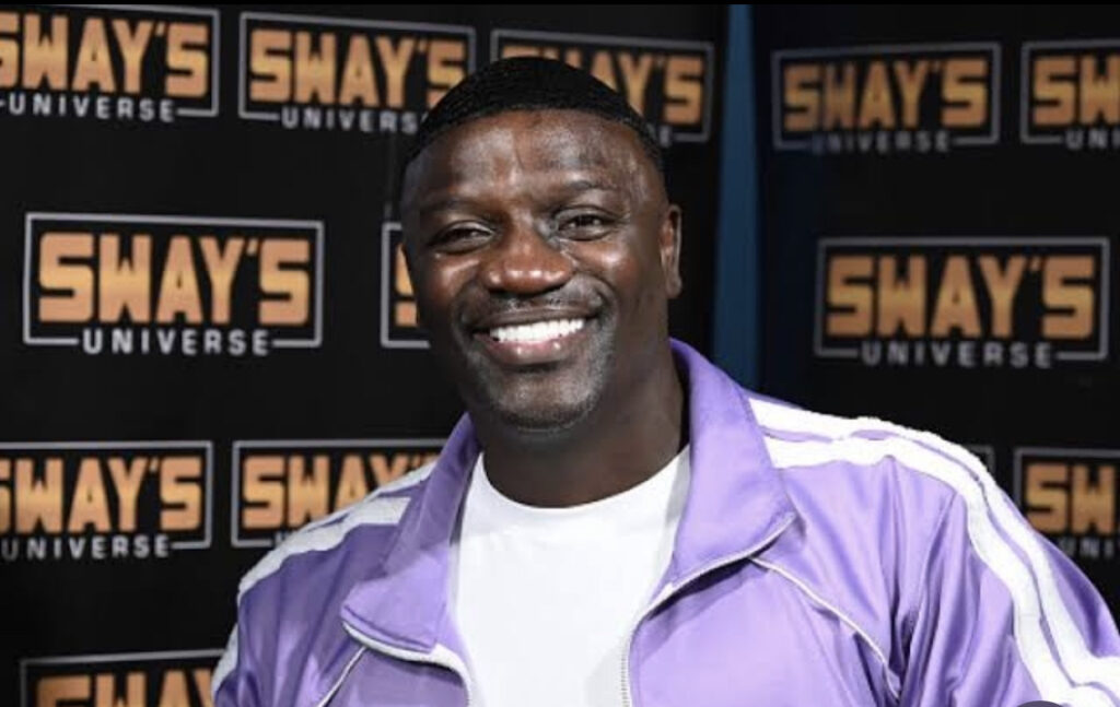 Akon Pays $7.5K for Hair Transplant In Turkey To Get New Hairline
