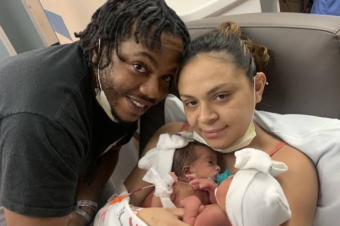 Over 50 doctors successfully separate conjoined Arciniega twins in historic surgery