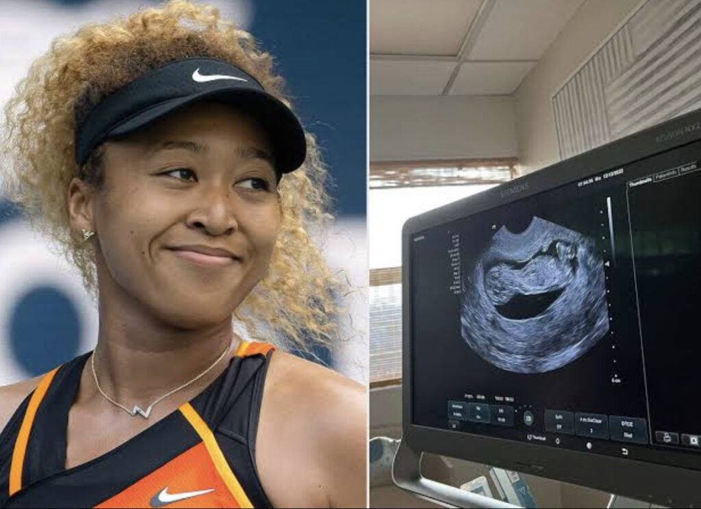 Tennis Champ, Naomi Osaka pregnant with her first child