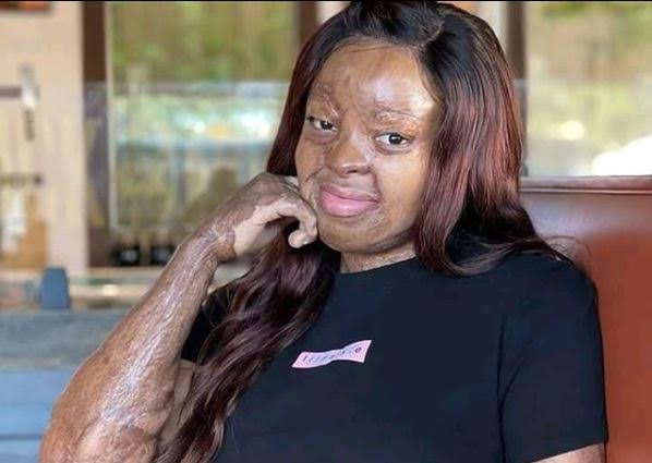 Black Woman, Kechi Okwuchi Who Survived a Plane Crash Earns Master’s Degree in Business