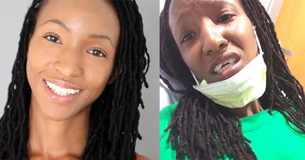 Brittany Chrishawn Launches Documentary ‘Unbroken Smile’ After Surviving Police Brutality